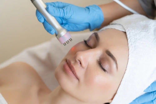 Microneedling Radiofrequency