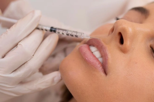 dermaroller treatment