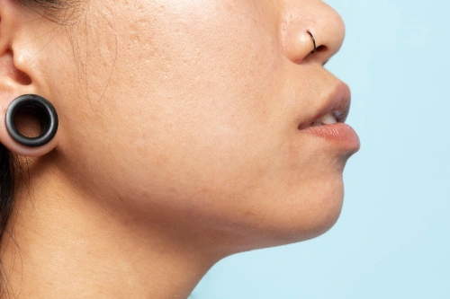 open pores treatment