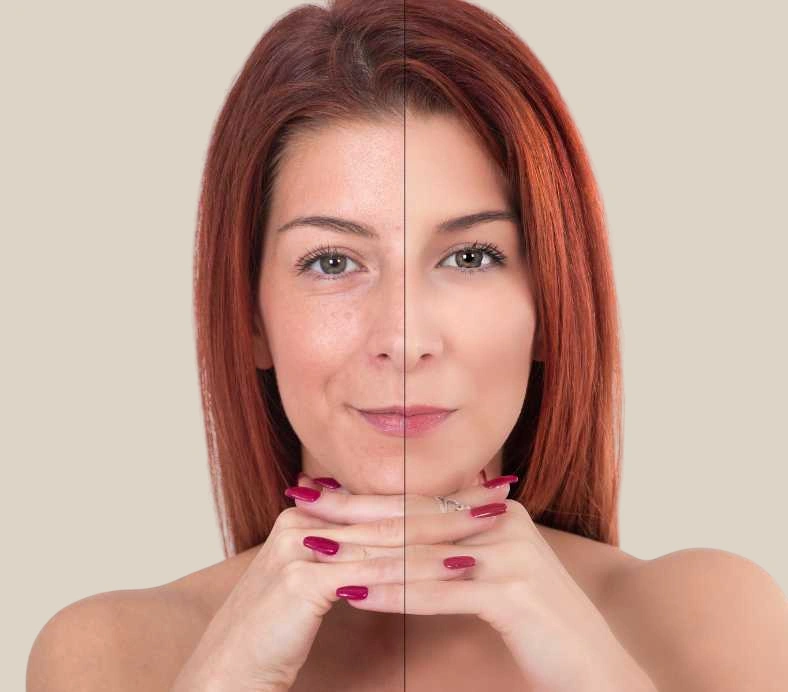 Skin Aging Treatment
