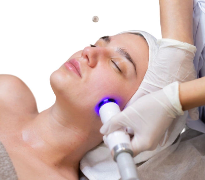 Microneedlin Radiofrequency