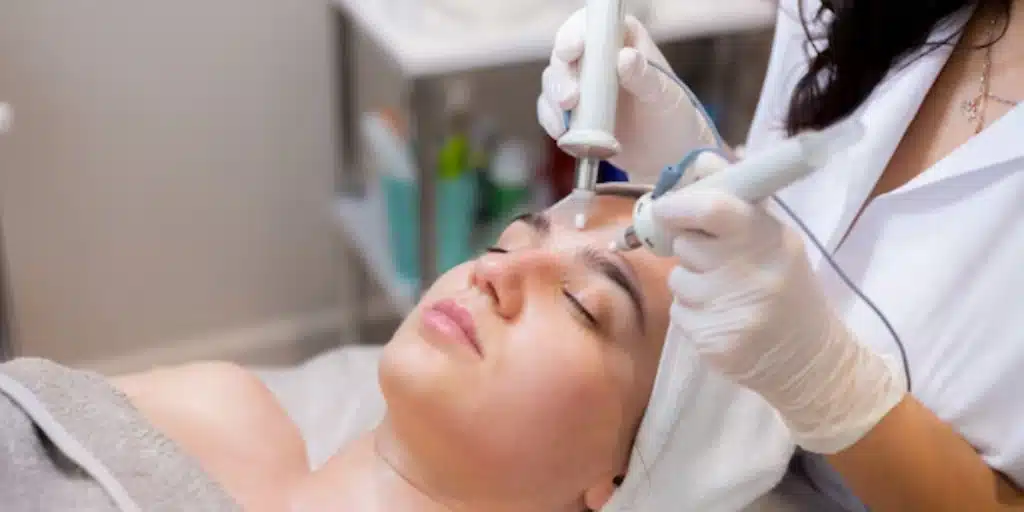 Laser or Chemical Peel: Which Treatment Works Better for Pigmentation?