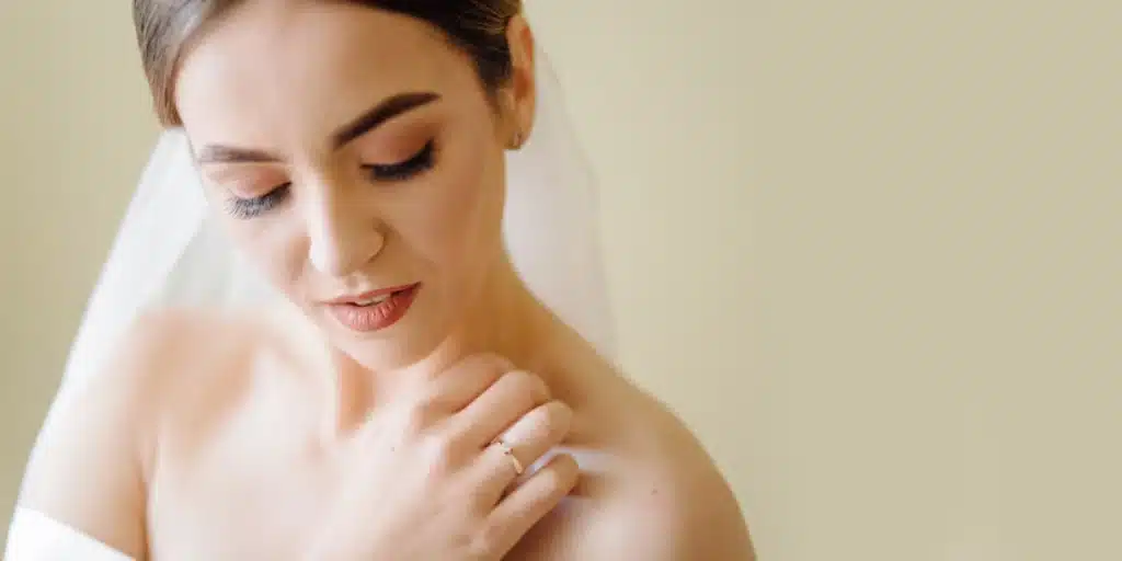 How to Get Clear Skin Before Your Wedding?